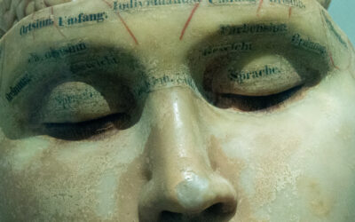 ”Antalet demenssjuka och kostnader för demenssjukdomar i Sverige 2023”